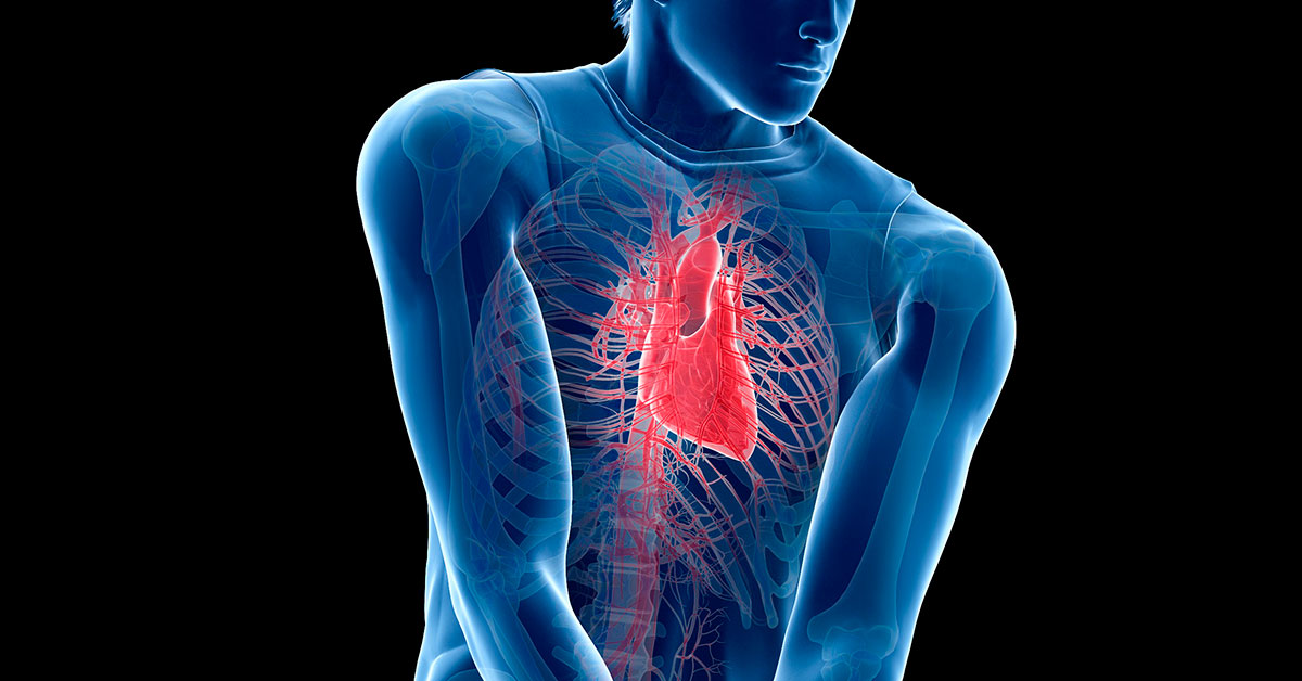 Cardiac Arrest - Heart180